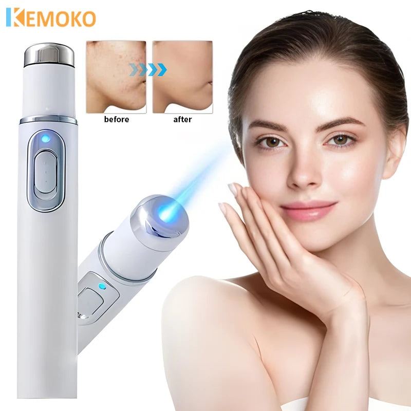 Blue Light Therapy Acne & Wrinkle Removal Laser Pen 🌟