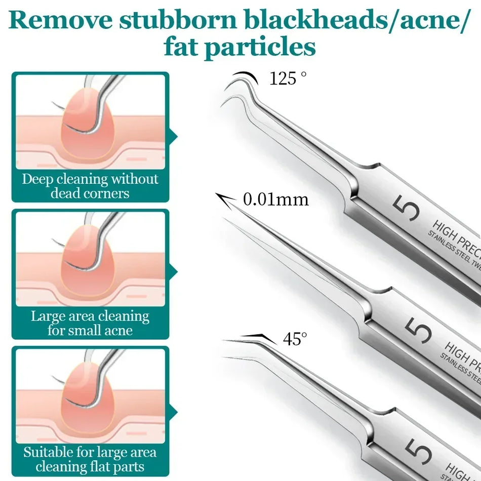 Fuarscs Blackhead Acne Extractor Tool Set - Ο σύντροφος της περιποίησης της επιδερμίδας σας για καθαρό δέρμα - Κύπρος