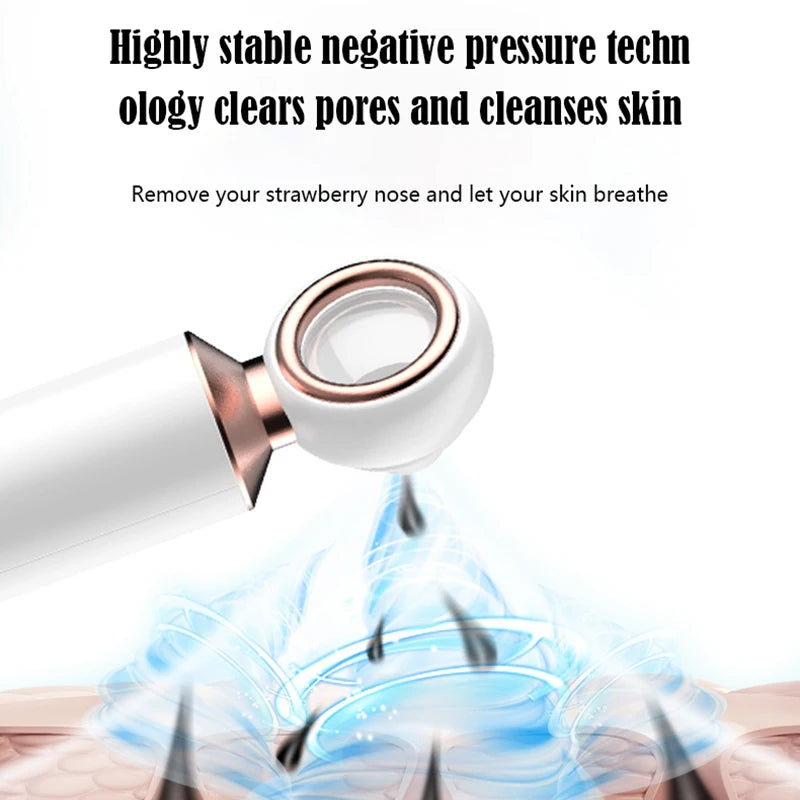 MI Electric Blackhead Remover Vacuum: Smooth & Clear Siol Solution