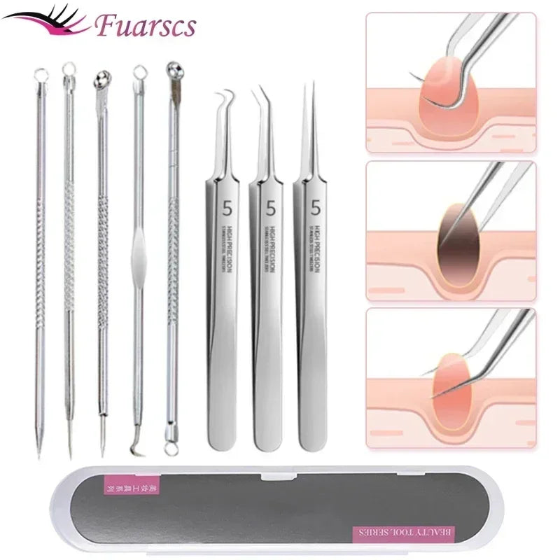 Fuarscs Blackhead Acne Extractor Tool Set - Ο σύντροφος της περιποίησης της επιδερμίδας σας για καθαρό δέρμα - Κύπρος